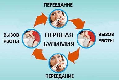 Лечение булимии в Салехарде